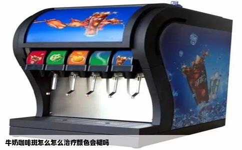 牛奶咖啡斑怎么怎么治疗颜色会褪吗